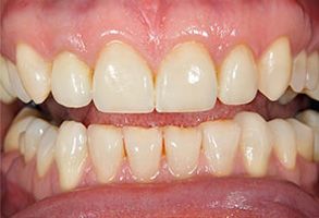 Woodlawn Heights dental images