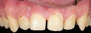 Dental Images near South East Yonkers